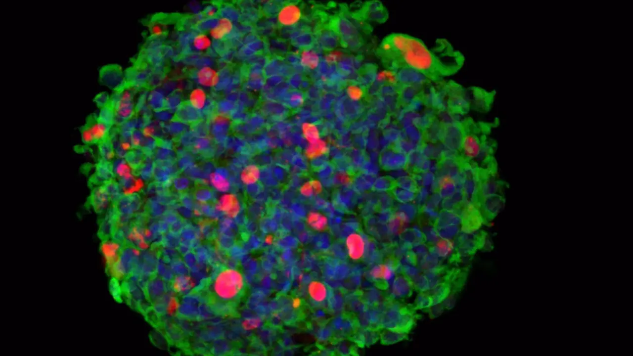 <p> Imagen 3D de inmuno-microscop&iacute;a confocal de una neuroesfera originada por c&eacute;lulas madre aisladas de un paciente de glioblastoma (GSC), e infectadas por el parvovirus Minute Virus of Mice (MVM). - CBMSO, UAM, CSIC </p>