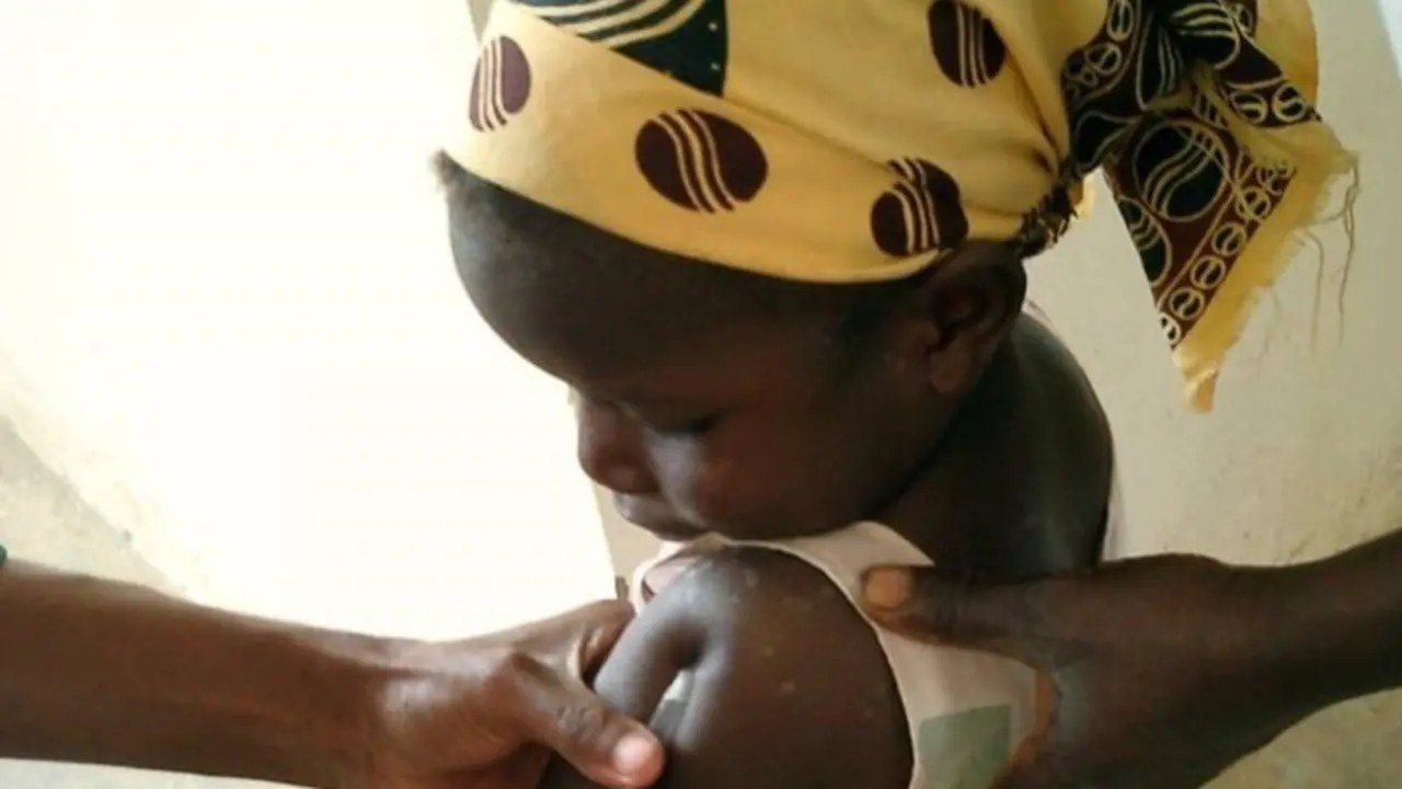 <p> Archivo - Una ni&ntilde;a en un centro de salud de Mozambique recibe una inyecci&oacute;n de la vacuna contra la malaria - ISGLOBAL - Archivo </p>