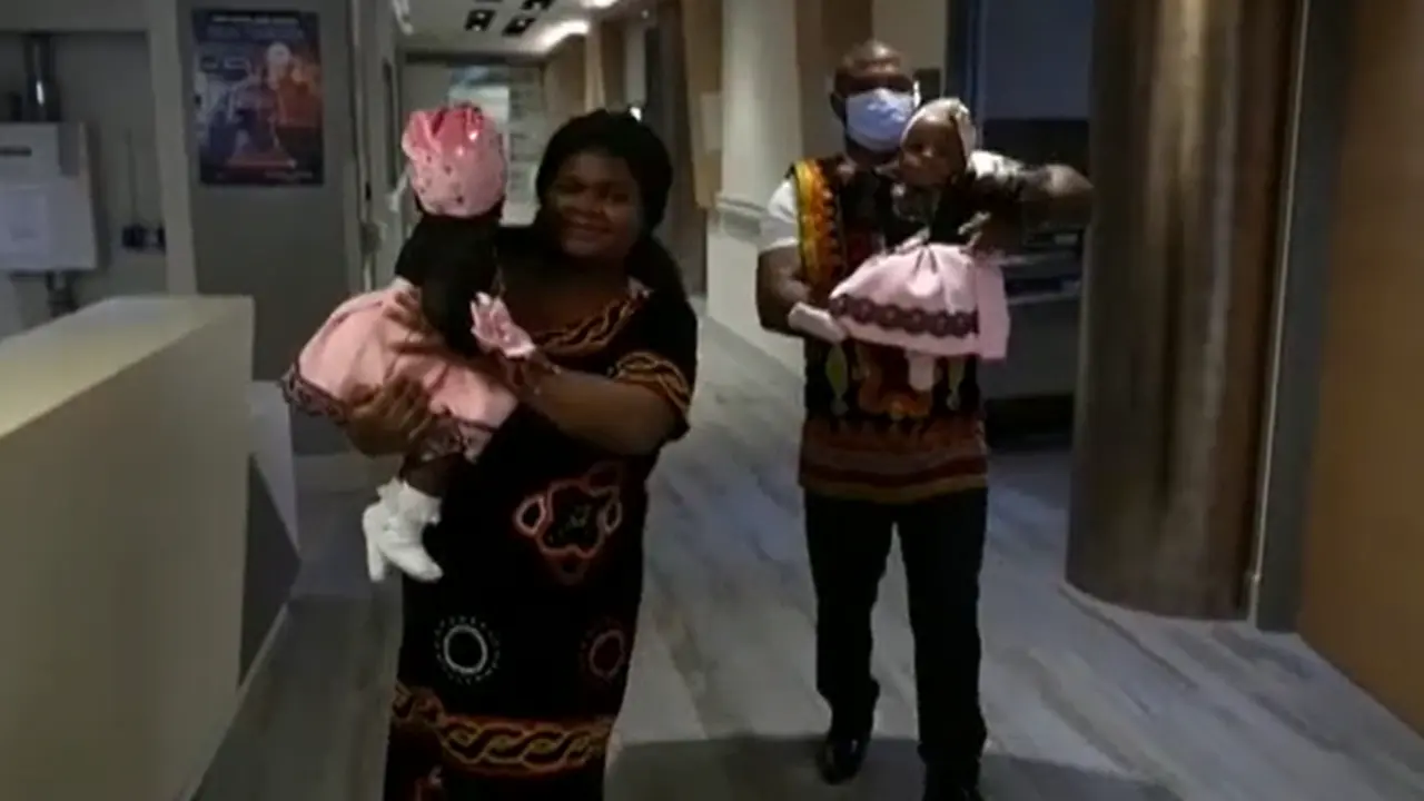 <p> Las gemelas tras la larga operaci&oacute;n. Fuente: Atlas </p>