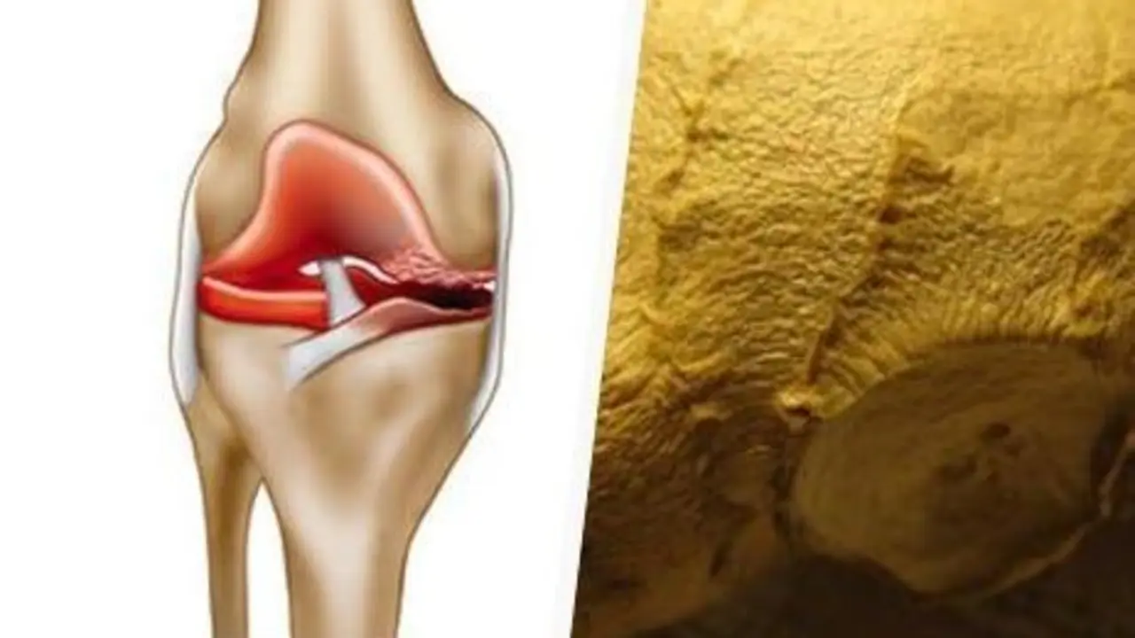 <p> rodilla con artrosis </p>