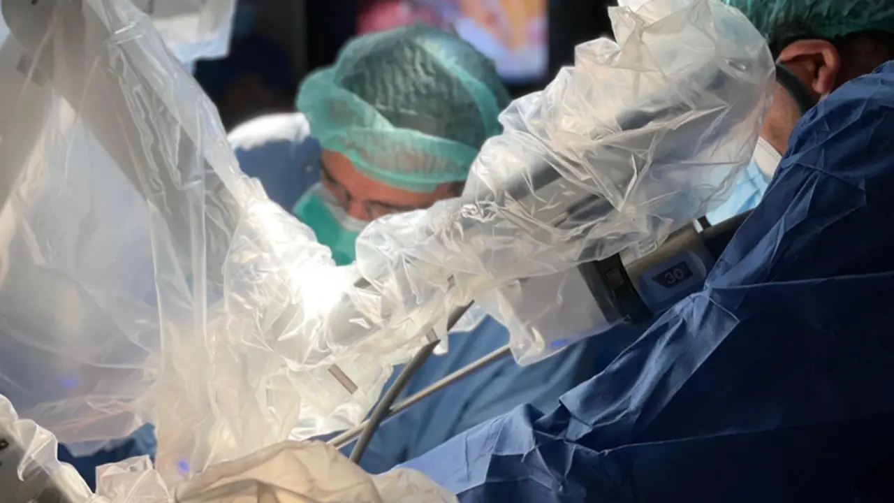 <p> El Hospital de Bellvitge extrae la primera costilla con cirug&iacute;a rob&oacute;tica y una incisi&oacute;n - HOSPITAL DE BELLVITGE </p>