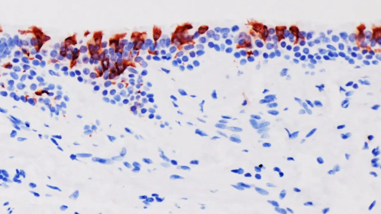 <p> La variante omicr&oacute;n del SARS-CoV-2 (en rojo) infectando tejidos de bronquios humanos. - UNIVERSIDAD DE HONG KONG </p>