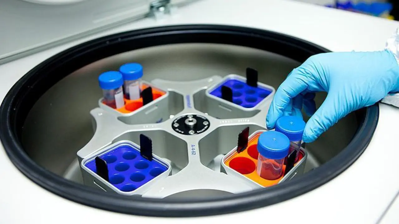 <p> Muestras donadas por pacientes con c&aacute;ncer para investigaci&oacute;n oncol&oacute;gica.- Junta de Andaluc&iacute;a </p>