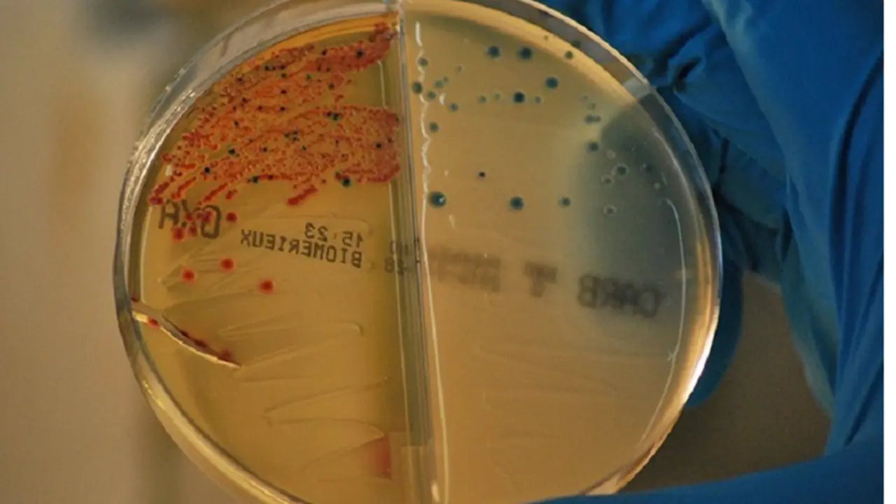 <p> Archivo - Bacterias resistentes a los antibi&oacute;ticos aisladas en el IRYCIS. / - JER&Oacute;NIMO RODR&Iacute;GUEZ BELTR&Aacute;N - Archivo </p>