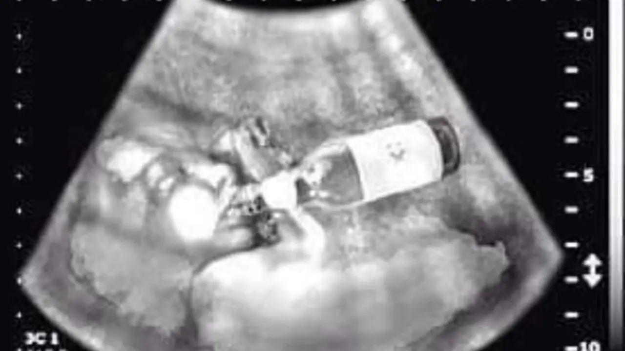 <p> ginec&oacute;logos advierten de los problemas del alcohol en el embarazo </p>