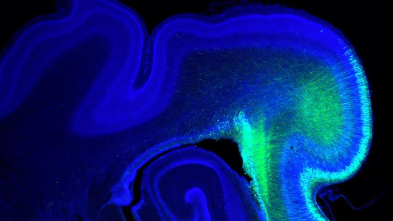 <p> Imagen del cerebro de un hur&oacute;n. - IN (CSIC-UMH) </p>