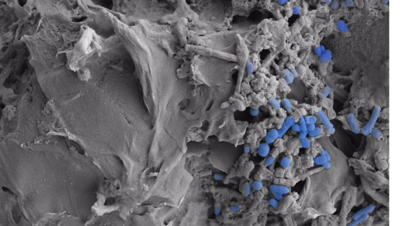 <p> Imagen microsc&oacute;pica de micropl&aacute;sticos colonizados por la microbiota intestinal. - CSIC </p>
