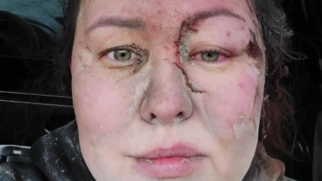 <p> Ayuna Morozova, entrenadora de la Federaci&oacute;n Ucraniana de Nataci&oacute;n, sufri&oacute; un bombardeo. - Twitter. </p>