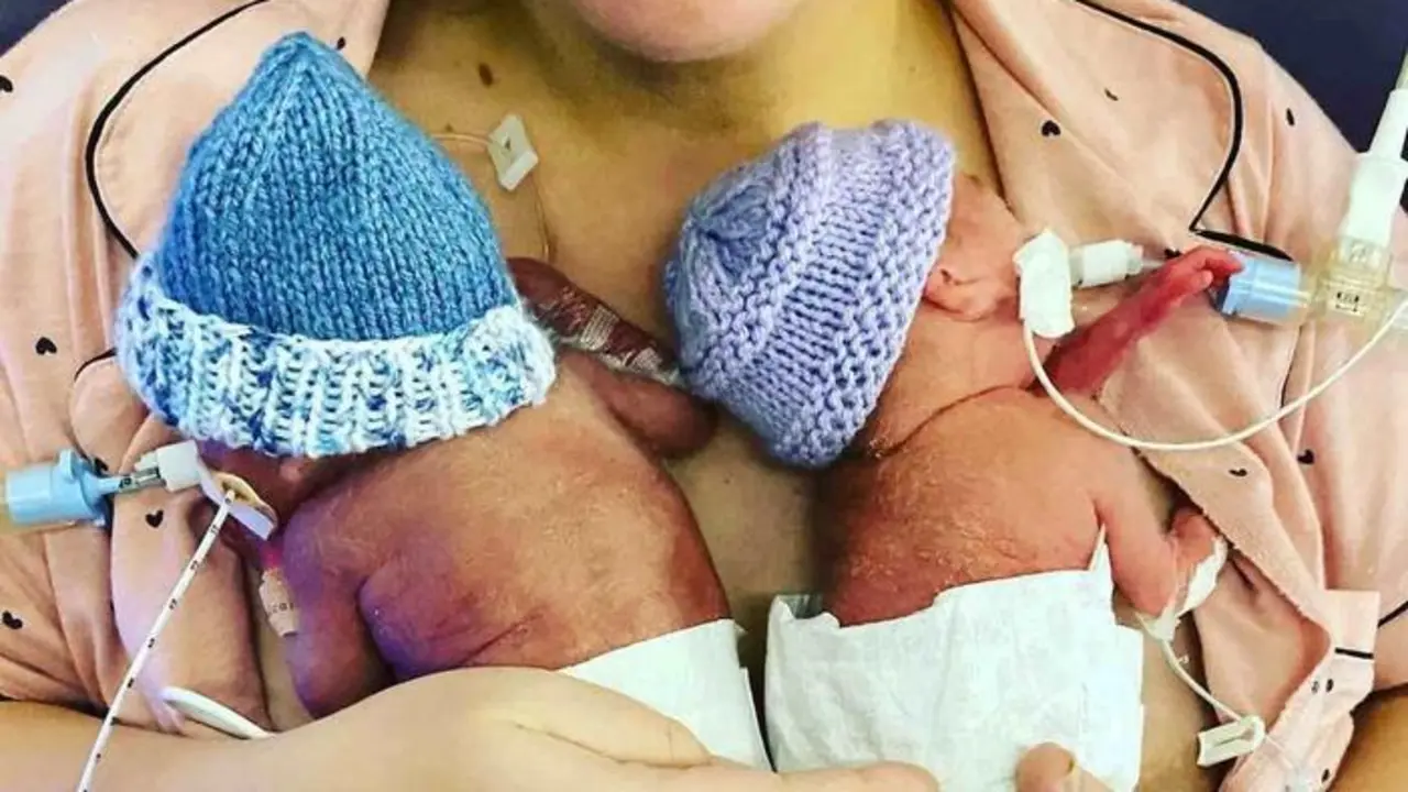 A mum has celebrated the arrival of the UK's most premature twins - who were given zero per cent chance of survival.See SWNS story SWSYtwins. A mum has celebrated the arrival of the UK's most premature twins - who were given zero per cent chance of survival. Little Harley and Harry Crane were conceived via IVF and were born at 22 weeks and five days - more than a week before the abortion limit.Babies born at 22 weeks are not classed as legally viable and medical intervention is sometimes not offered. But the tough siblings weren't going anywhere and have amazed doctors - who initially gave them a zero per cent chance of survival.
