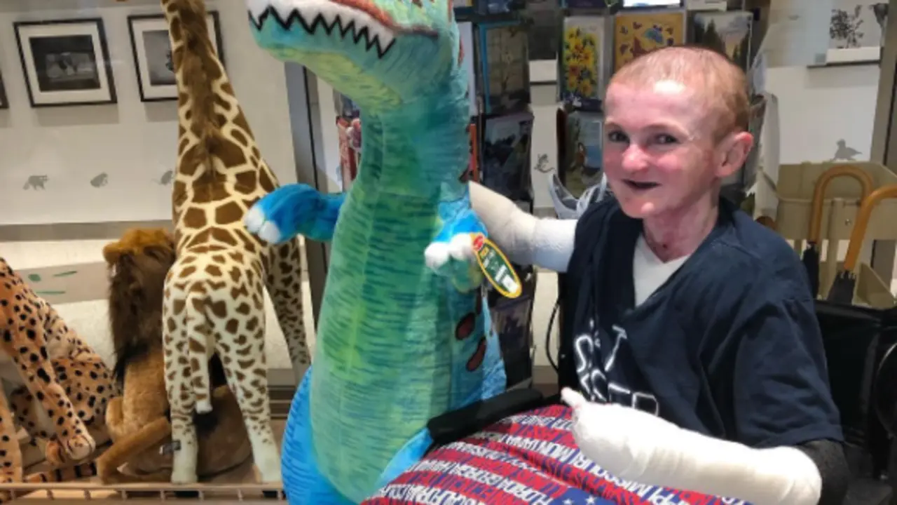 <p> Garrett Spaulding, joven que padece la piel de mariposa | @gfampk.ttv </p>