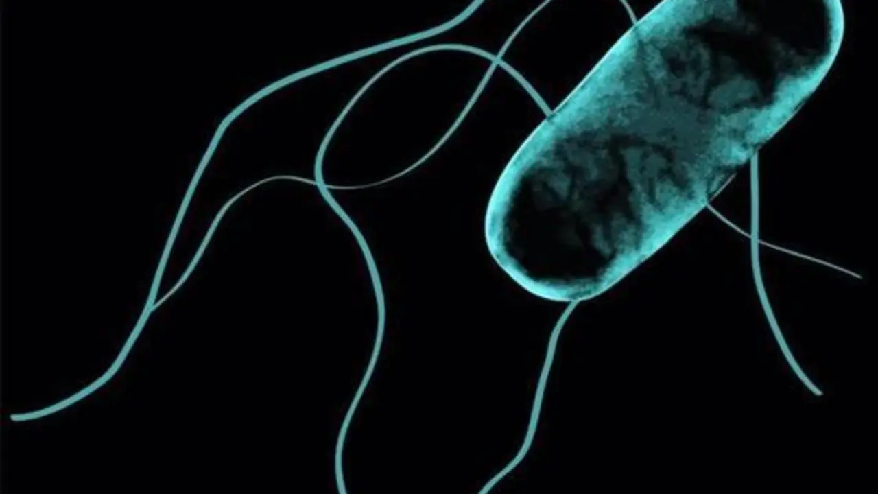 <p> Archivo - Salmonella africana. - DRA. SIAN OWEN Y DRA. ROCIO CANALS </p>