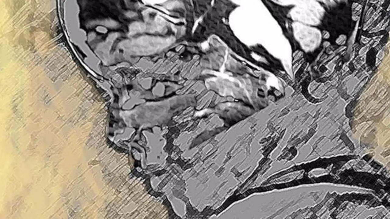 05/04/2022 Paciente con leucodistrofia.
ESPA&radic;&euml;A EUROPA MADRID SALUD
NATHALIE LAUNAY.
