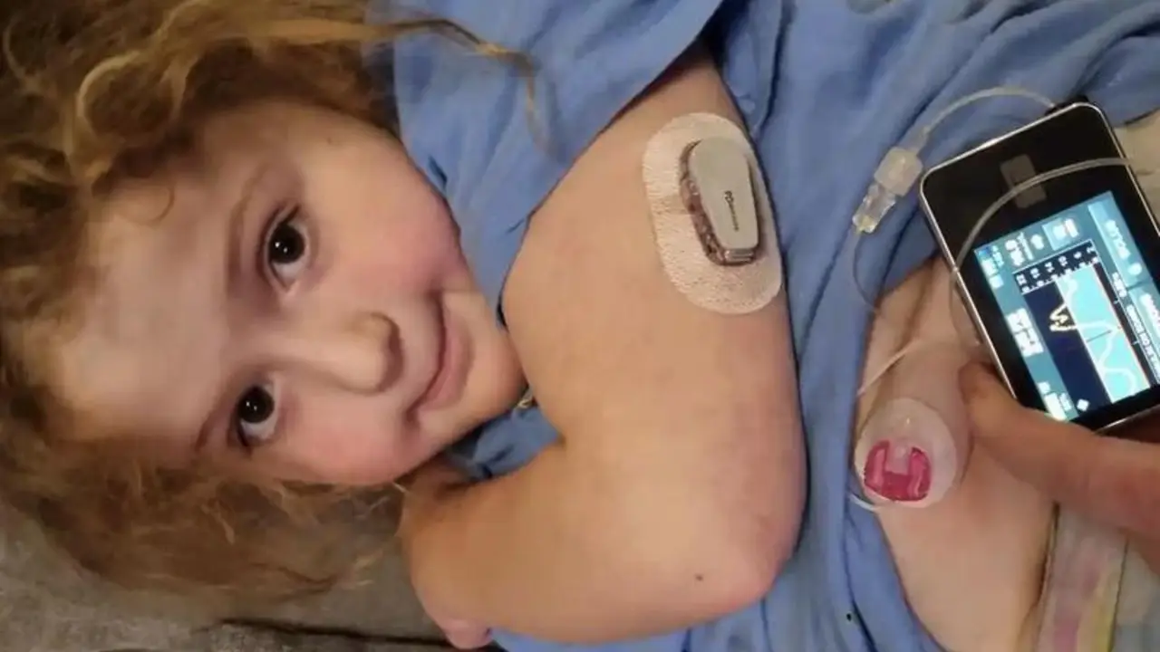 <p> Charlotte Abbott-Pierce con su p&aacute;ncreas artificial - NHS </p>