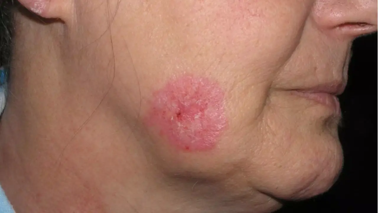 <p> El diagn&oacute;stico del lupus y su seguimiento, claves para la calidad de vida de los pacientes afectados por la enfermedad. Fuente: Europa Press </p>