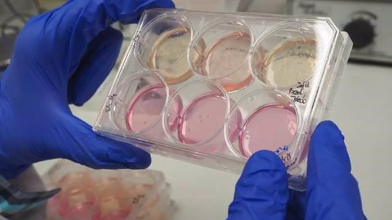 <p> Archivo - Pocillos con c&eacute;lulas tumorales - GEMA DE LA ASUNCI&Oacute;N / CSIC COMUNICACI&Oacute;N - Archivo </p>