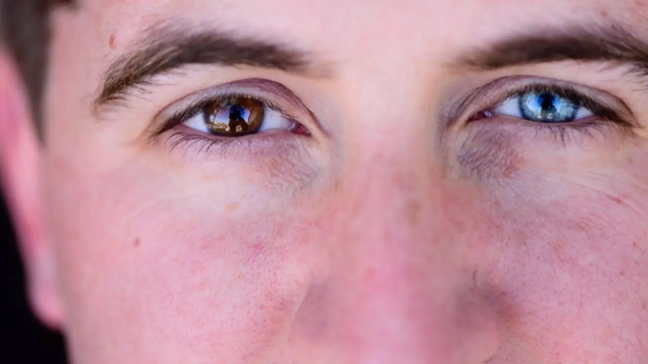 <p> Archivo - Heterocrom&iacute;a. Ojos de distinto color. - WHITNEYLEWISPHOTOGRAPHY/ISTOCK - Archivo </p>