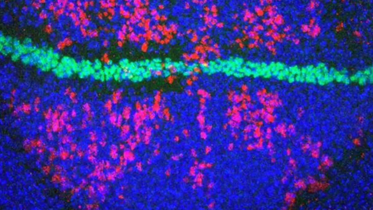 <p> Disco imaginal de 'Drosophila' sometido a radiaci&oacute;n ionizante y te&ntilde;ido con marcadores de muerte celular (rojo), de n&uacute;cleos (azul) y del borde dorso-ventral (verde). - CBMSO </p>