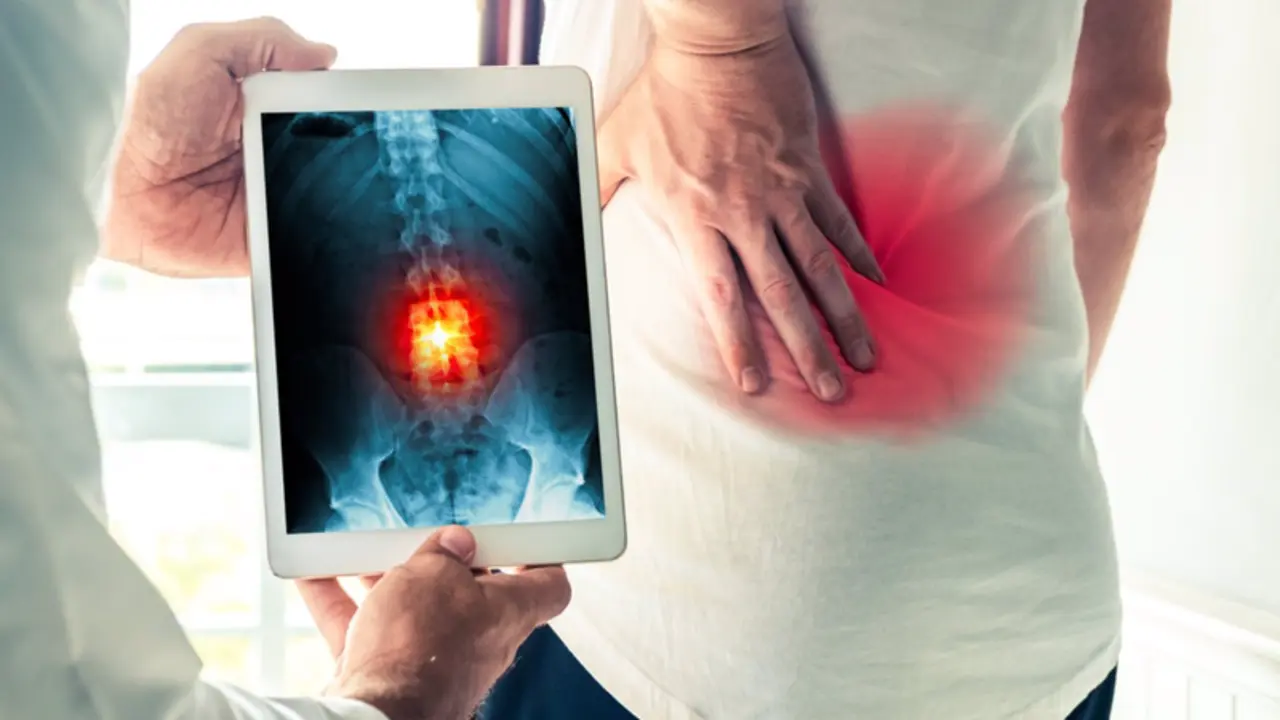 <p> Archivo - Dolor de espalda. - STEPHANE NOIRET/ISTOCK - Archivo </p>