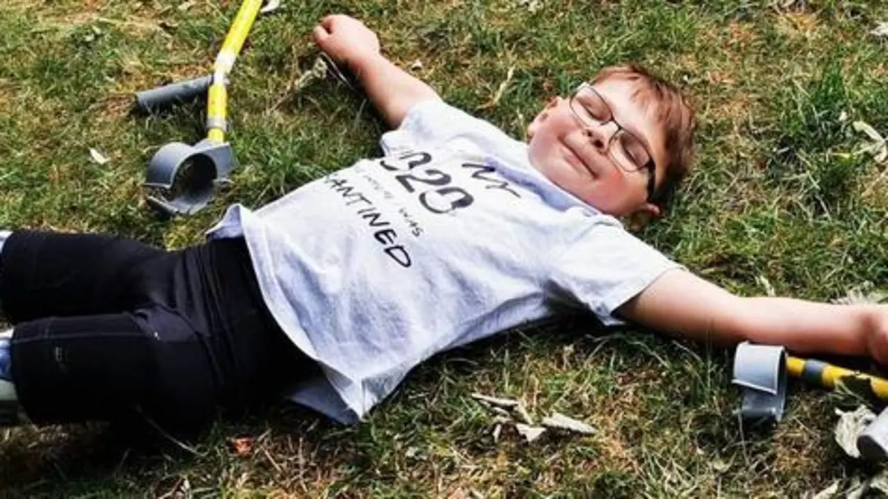 <p> Tony, ni&ntilde;o al que tuvieron que amputar ambas piernas </p>