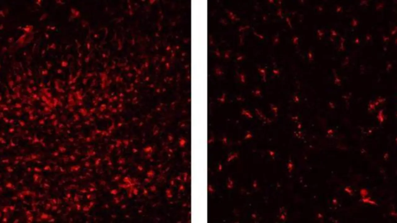 <p> Muerte neuronal </p>