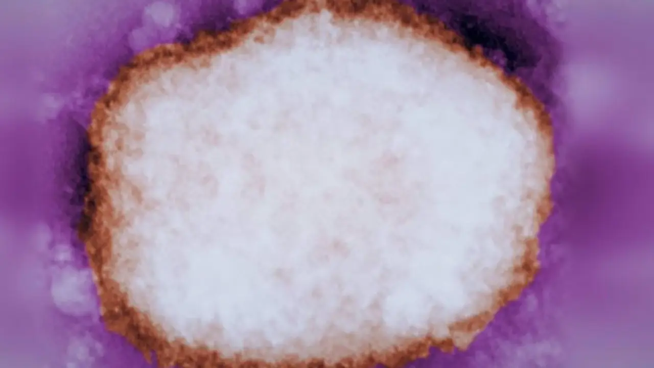 <p> Part&iacute;cula amplificada del virus de la viruela del mono. - CDC </p>