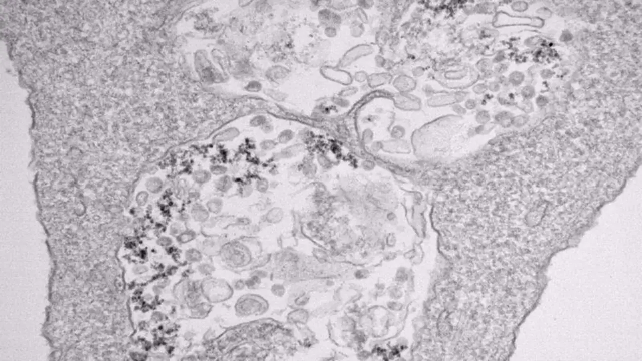<p> Imagen de microscop&iacute;a de transmisi&oacute;n electr&oacute;nica de c&eacute;lulas infectadas con SARS-CoV-2 y tratadas con nanopart&iacute;culas de &oacute;xido de hierro. - CNB-CSIC </p>