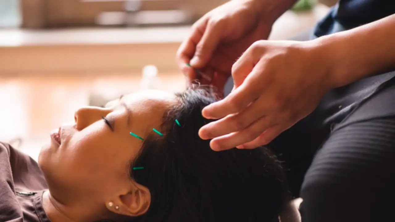 <p> Archivo - Acupuntura - HELOVI/ ISTOCK - Archivo </p>