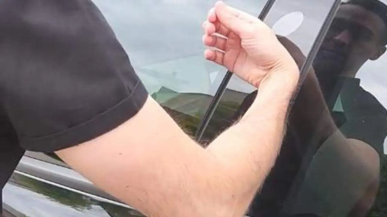 <p> Un hombre se implanta en la mano la llave de su Tesla.BrandonDalaly / TWITTER </p>