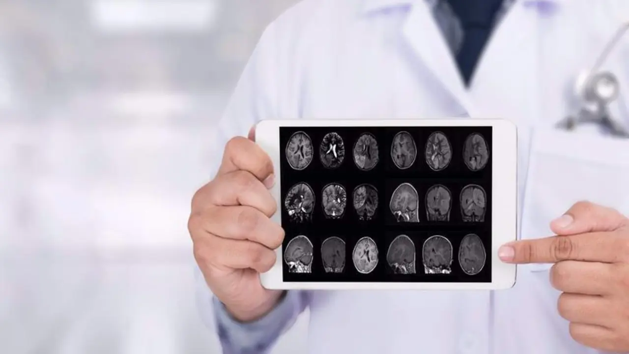 <p> Radiograf&iacute;a del cerebro humano </p>