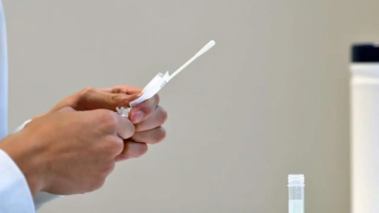 <p> Prueba de RT-PCR para la infecci&oacute;n por SARS-CoV-2 </p>