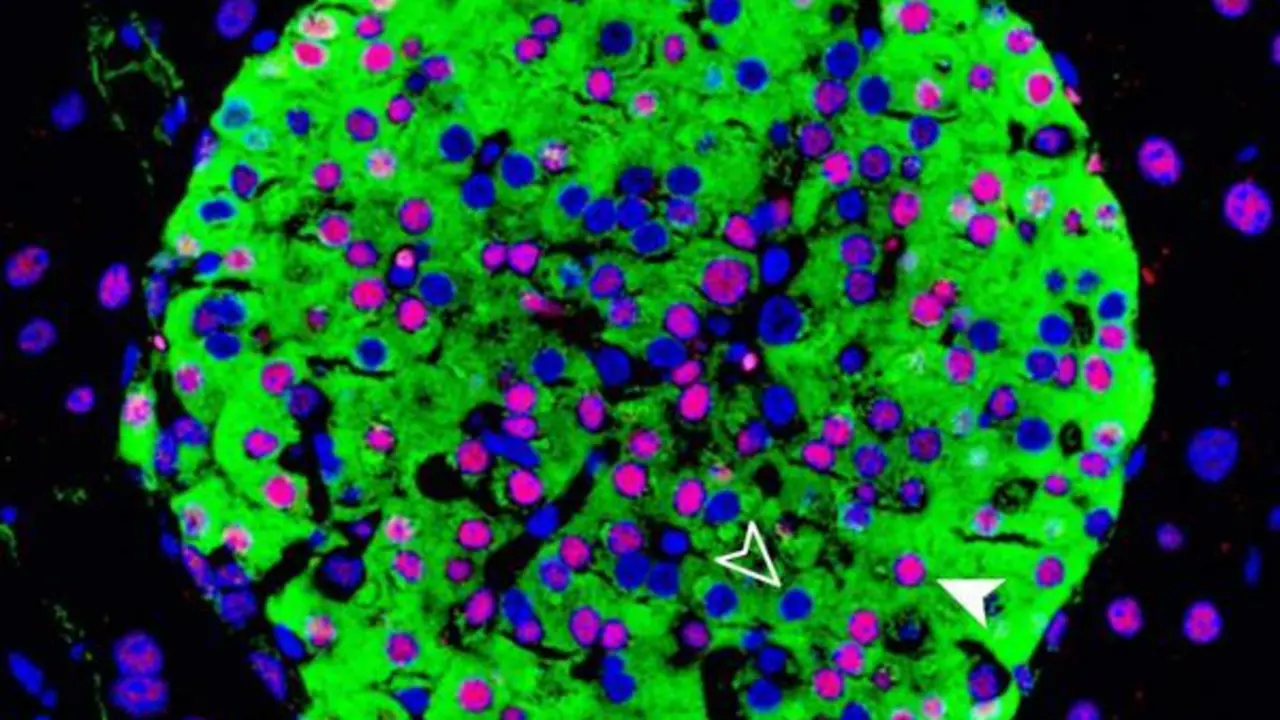 <p> Gen investigado </p>