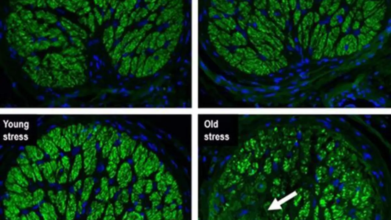  En la cabeza del nervio &oacute;ptico joven no hab&iacute;a signos de p&eacute;rdida de axones. Sin embargo, en los nervios &oacute;pticos de animales viejos, se observ&oacute; una importante p&eacute;rdida sectorial de axones, similar al fenotipo com&uacute;nmente observado en pacientes con glaucoma 