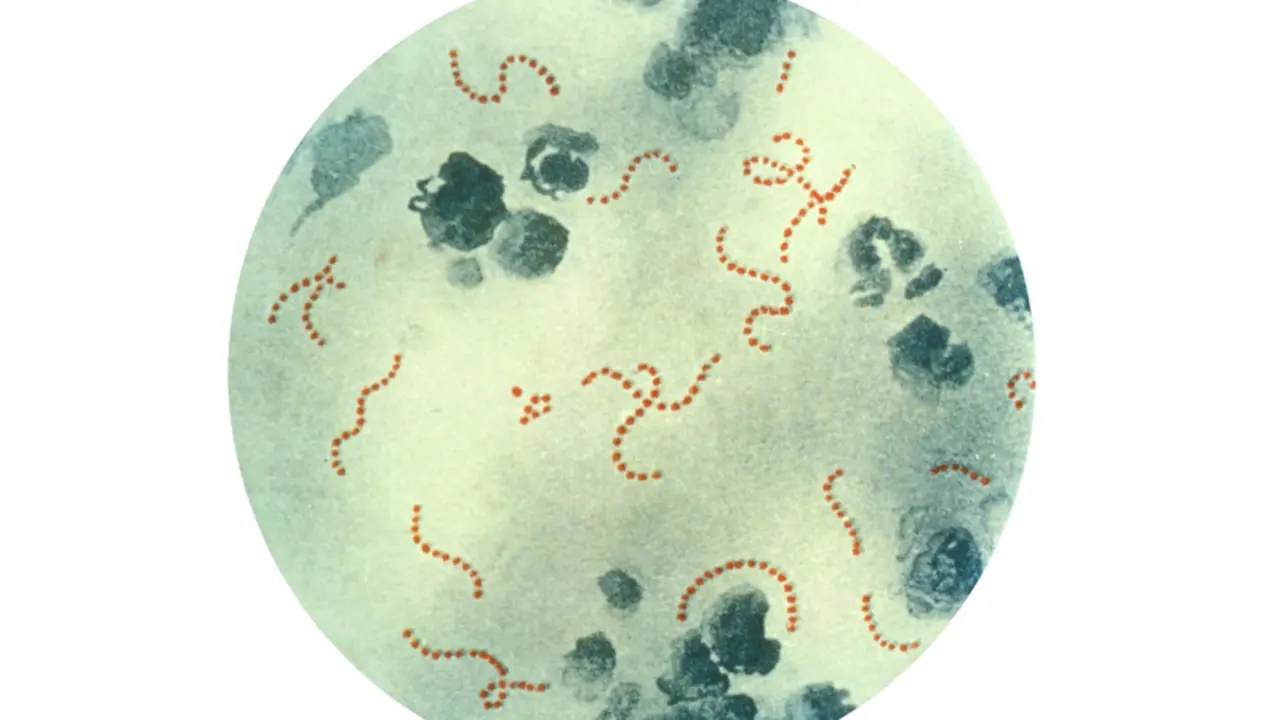  Archivo - La bacteria 'Streptococcus pyogenes', conocida en espa&ntilde;ol como estreptococo - PUBLIC HEALTH IMAGE LIBRARY - Archivo 