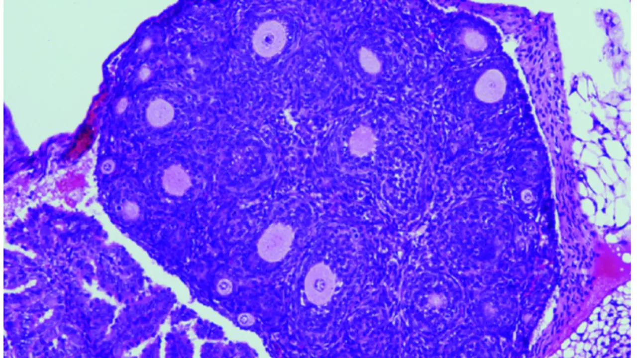  Reducci&oacute;n en el n&uacute;mero de fol&iacute;culos ov&aacute;ricos (causante de la insuficiencia ov&aacute;rica prematura) en los ratones con la variante humanizada en FOXL2. / Centro de Investigaci&oacute;n del C&aacute;ncer (CSIC-USAL) 