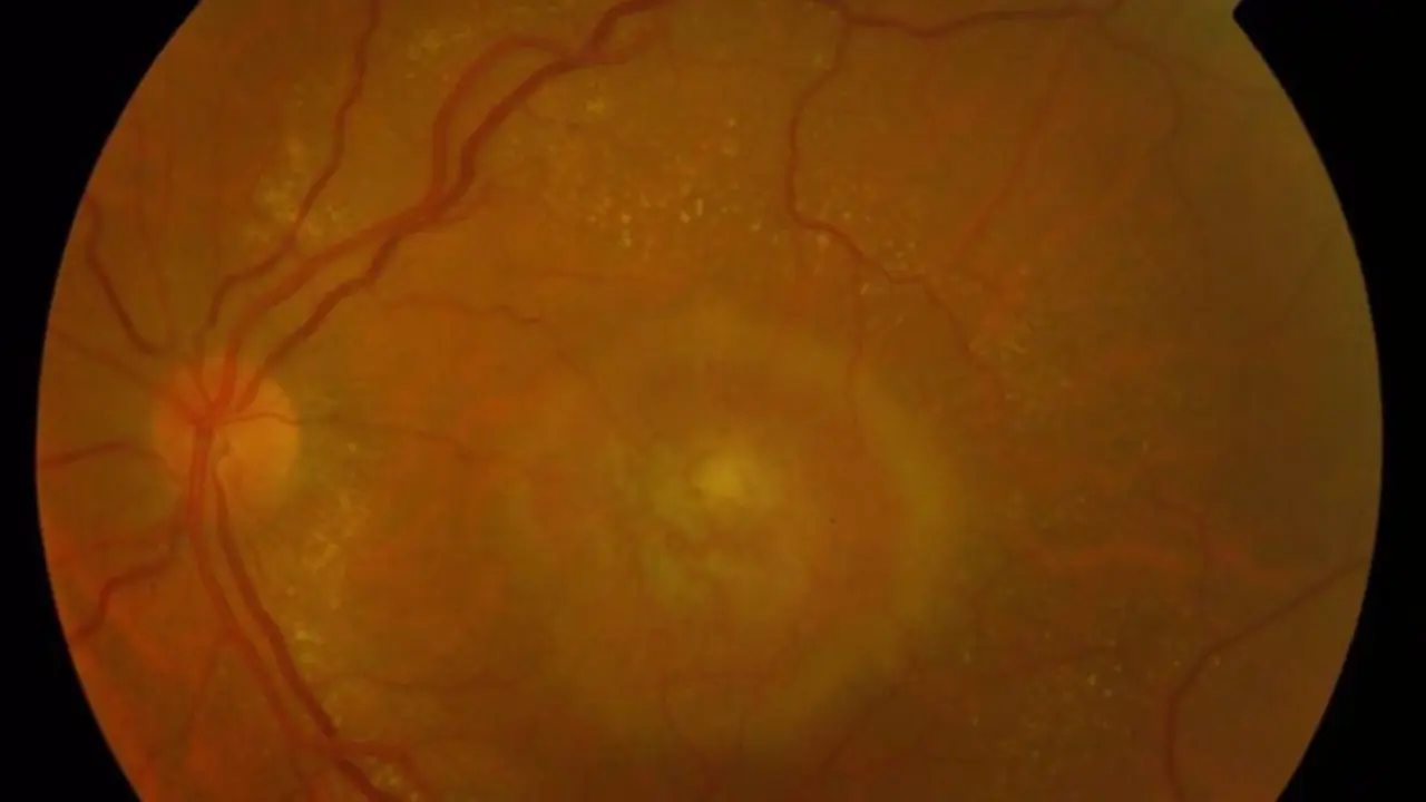  Archivo - DMAE - OPTRETINA - Archivo 