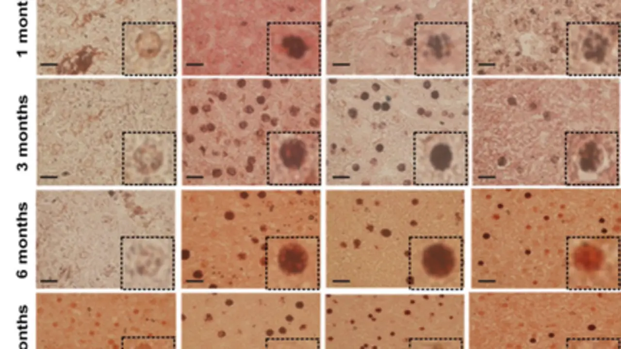  Investigadores del CSIC descubren c&oacute;mo los recubrimientos de las nanopart&iacute;culas afectan a su biodistribuci&oacute;n y degradaci&oacute;n. - UNIVERSIDAD DE ZARAGOZA 