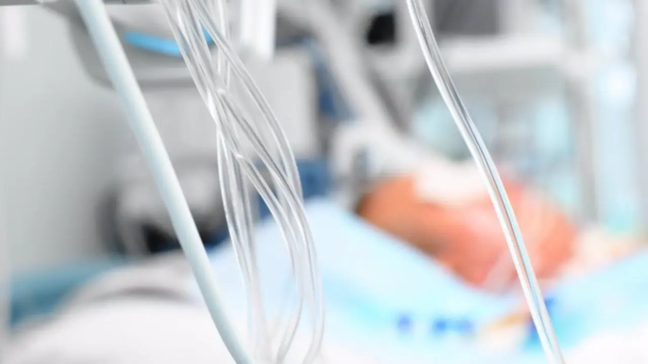  Archivo - UVI, UCI, cuidados intensivos, paciente intubado - ATS - Archivo 