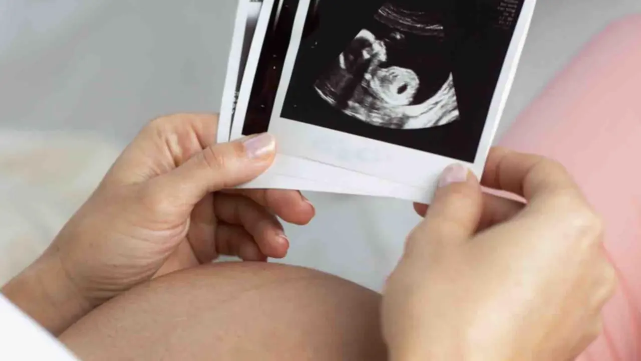  Archivo - Embarazo - CL&Iacute;NICA MARGEN - Archivo 