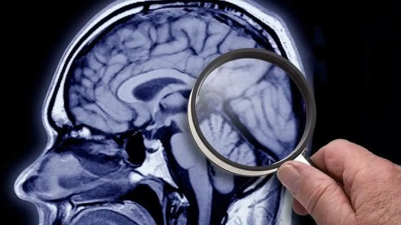  Foto de un cerebro. V&iacute;a: twitter 