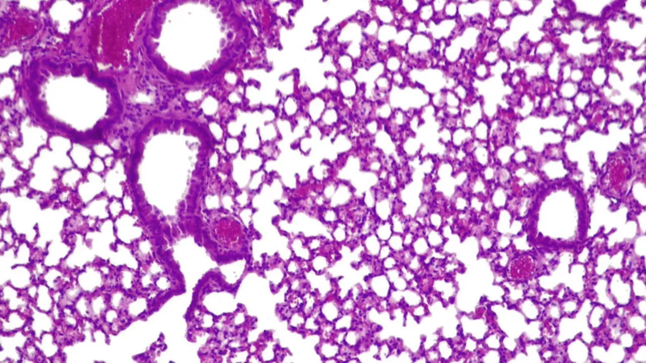  Pulmones de rat&oacute;n con 'pildora viva' activa combatiendo 'presudomonas aerugionosa' - CGR/PULMOBIOTICS 