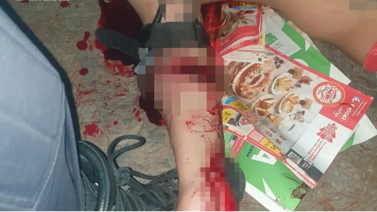  Polic&iacute;a Nacional auxilia al hombre que se estaba desangrando 