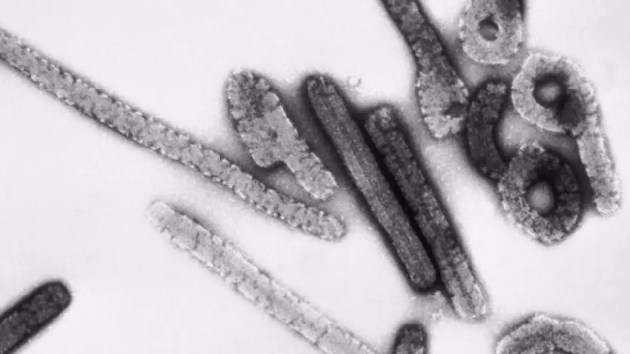  Archivo - Virus de Marburgo. - CDC - Archivo 