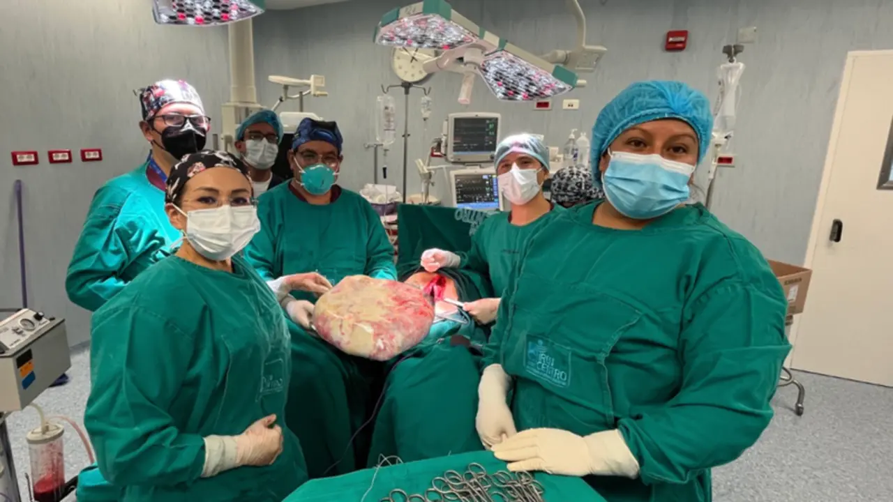  Profesionales junto al tumor extirpado 