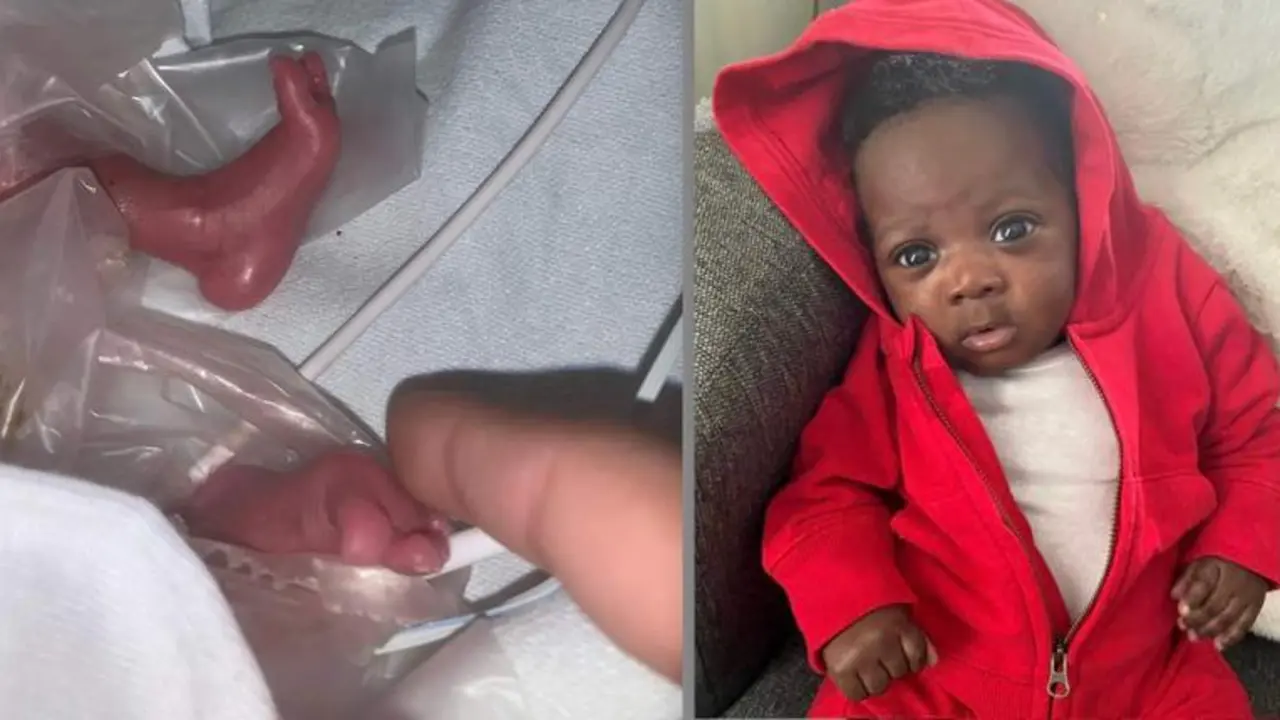  El peque&ntilde;o Kayden al nacer y ahora que ha pasado un mes 