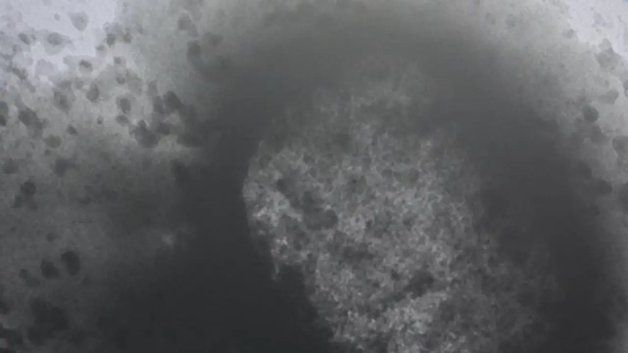  Archivo - Una mol&eacute;cula de la viruela del mono como resultado de un estudio de la universidad Carlos III durante la rueda de prensa posterior al Consejo Interterritorial del SNS, a 25 de mayo de 2022, en Madrid (Espa&ntilde;a). - Jes&uacute;s Hell&iacute;n - Europa Press - Archivo 