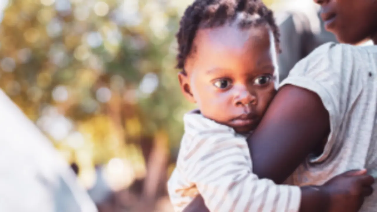  Desnutrici&oacute;n infantil (Pixabay) 