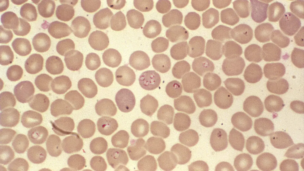  1979<br>Steven Glenn<br>Laboratory & Consultation Division<br><br>Other hemoprotozoan parasites such as these <i>Babesia sp.</i> organisms resemble <i>P. falciparum</i> organisms. <br><br>Though developmentally the <i>Babesia spp.</i> organisms resemble <i>Plasmodium falciparum</i>, these parasites present several distinguishing features: they vary more in shape and in size; and they do not produce pigment. 
