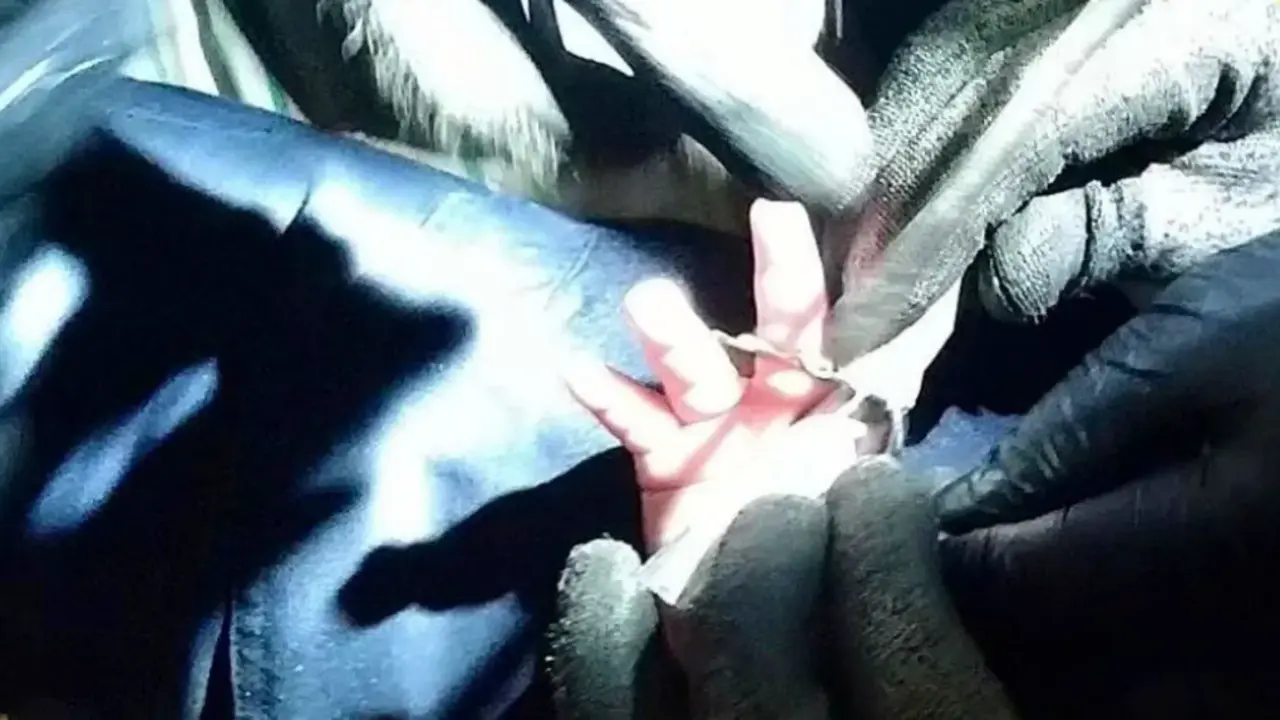  Liberan los dedos de un beb&eacute; de un desag&uuml;e 