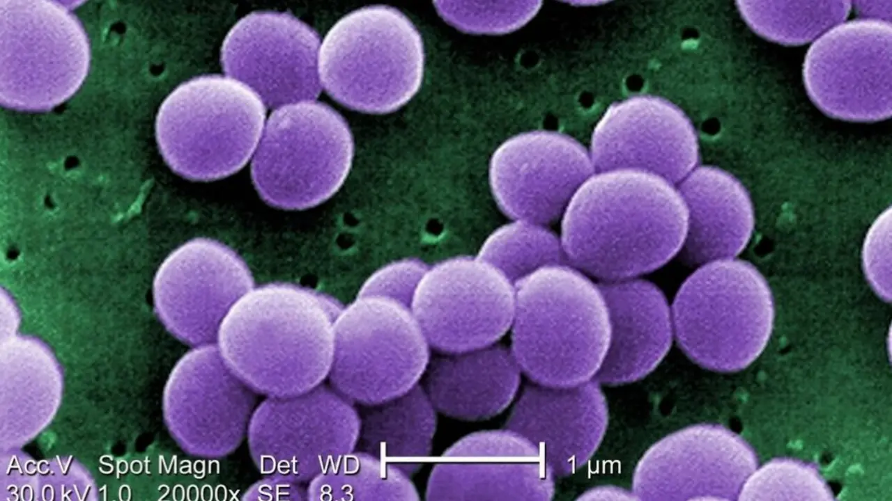  VRSA under a microscope 