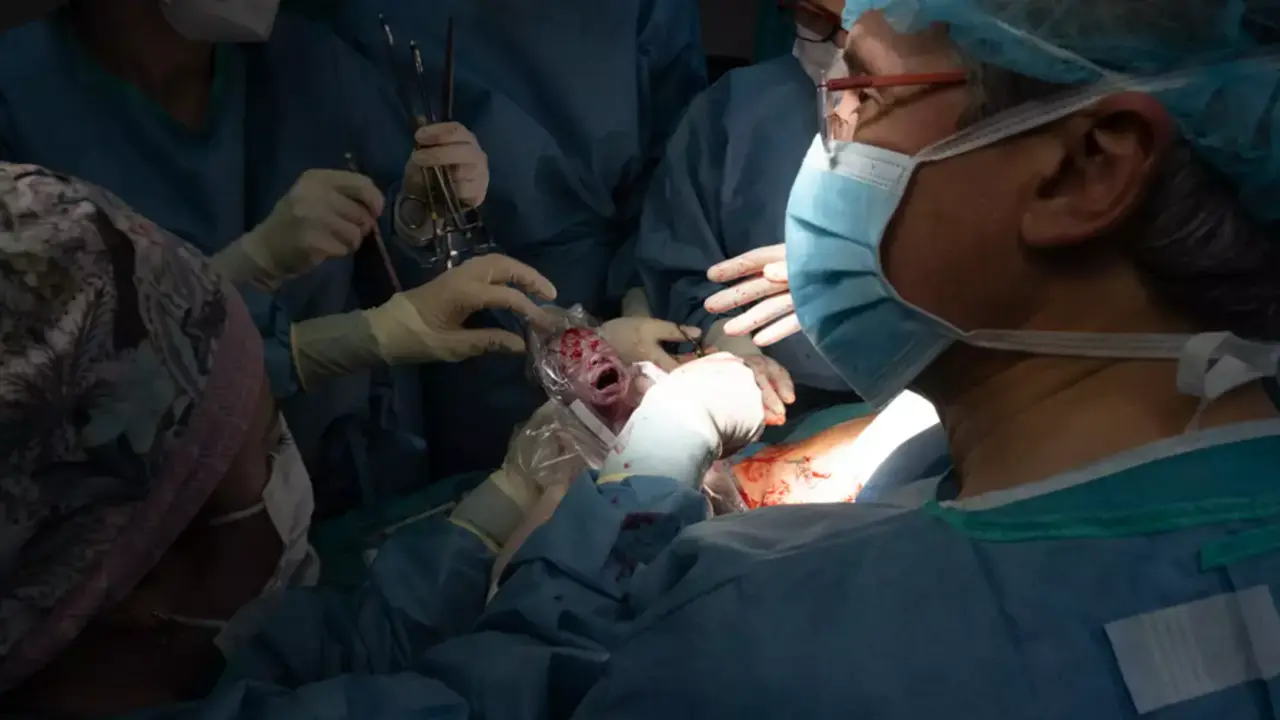  Momento del nacimiento de Jes&uacute;s, por ces&aacute;rea, en el Cl&iacute;nic | Francisco Avia 